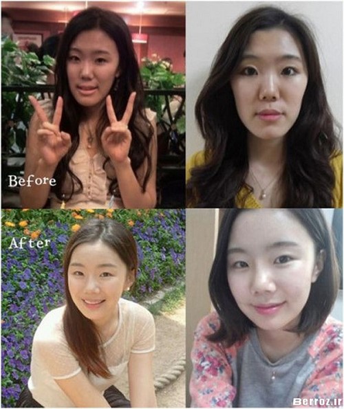 Cosmetic surgery (1)