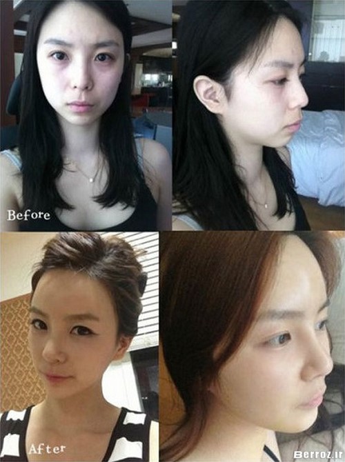 Cosmetic surgery (5)