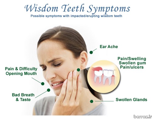 wisdom_teeth_symptoms_guelph