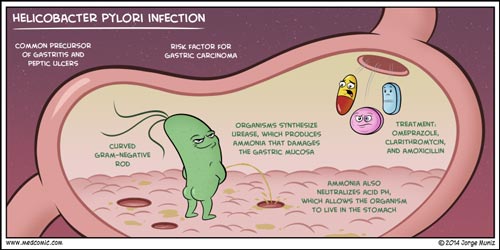 H. pylori Infection - Medcomic