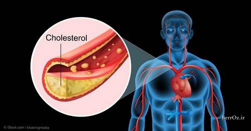 کاهش کلسترول بد خون